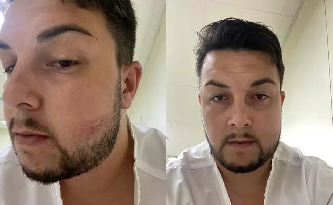 Torcedor cruzeirense relata momentos de terror ao ser agredido pela PM